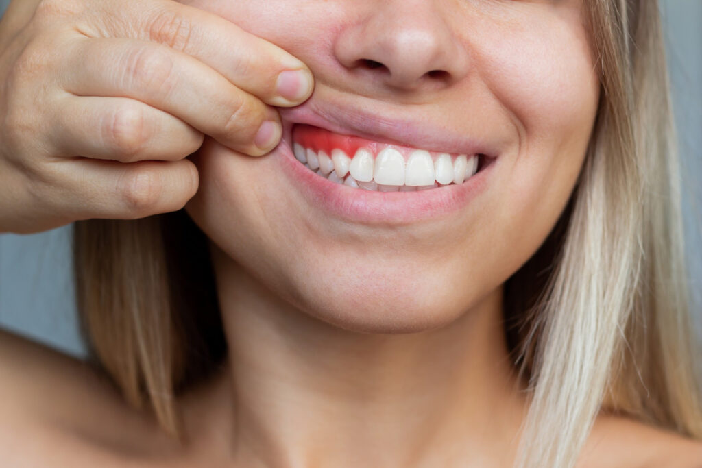 gum disease treatment san marcos