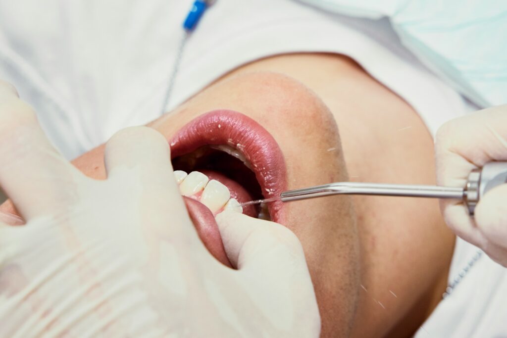 dental bridge